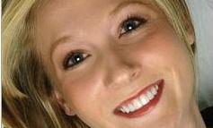 Crowns-Veneers-After-Image